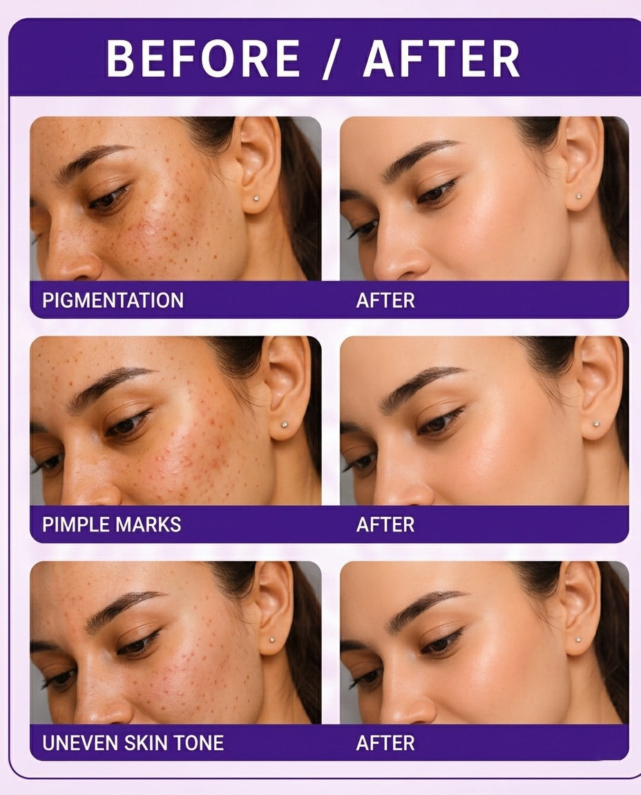Night Cream / Blackberry Face Wash / SPF Sunscreen 50++ Gel